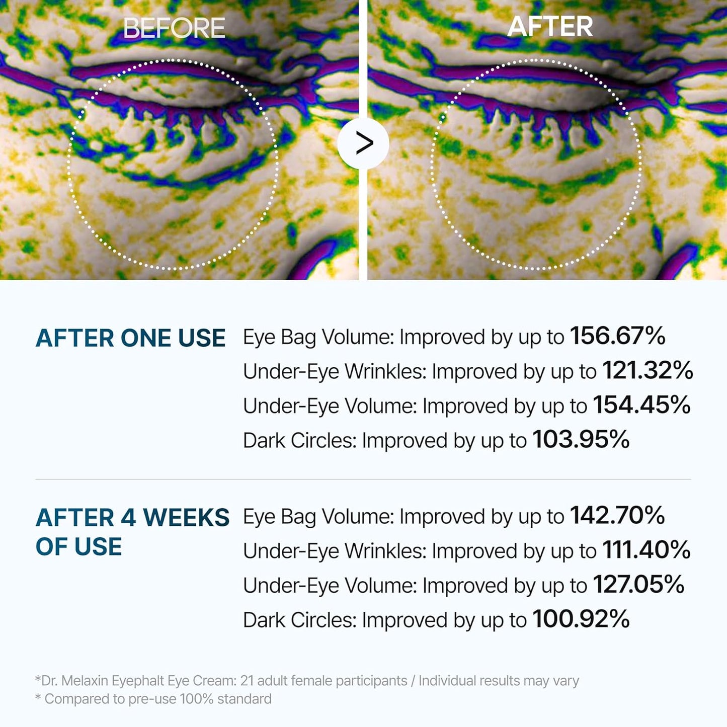 Dr.Melaxin, Eyephalt, Eyecream for Eyebags(Original)