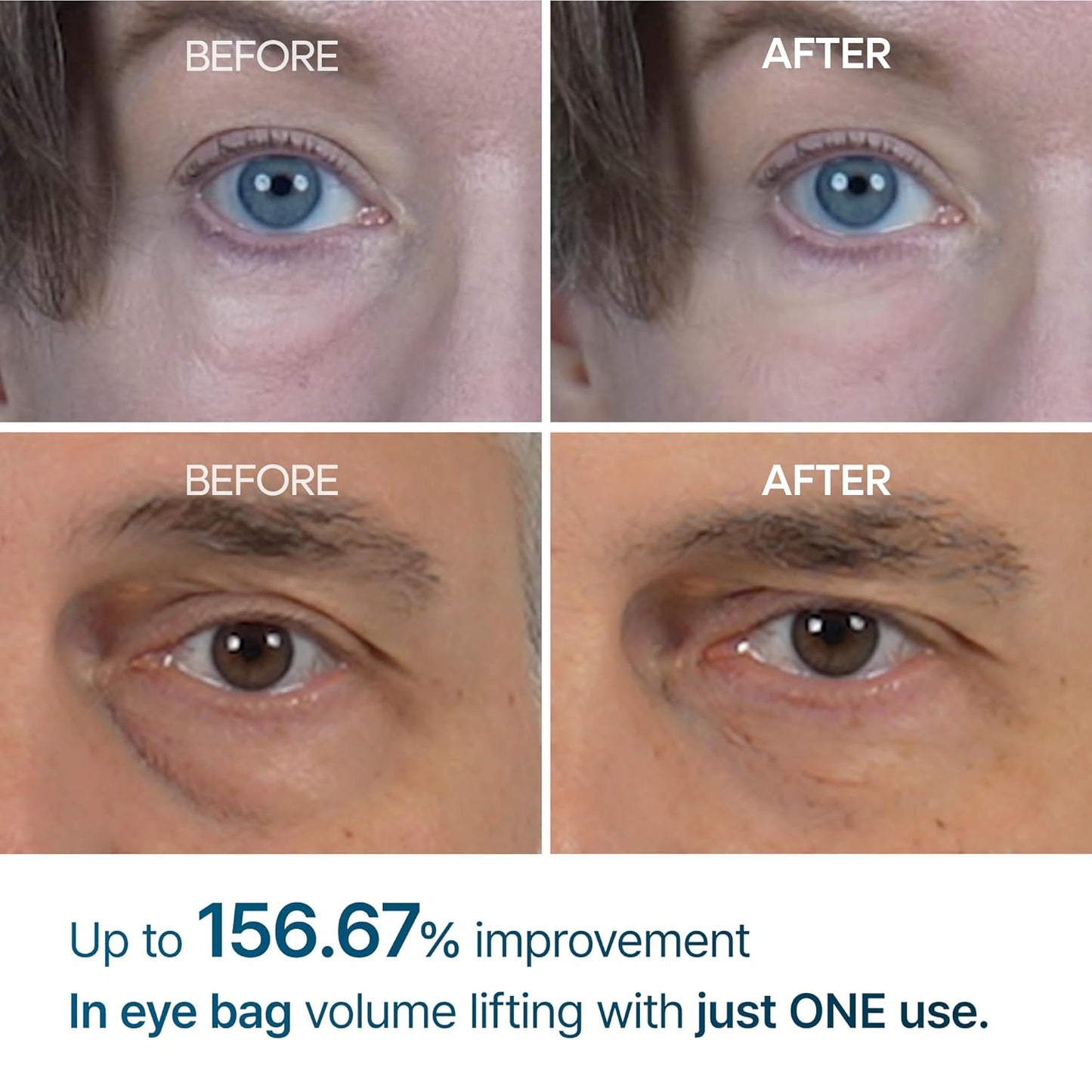 Dr.Melaxin, Eyephalt, Eyecream for Eyebags(Original)
