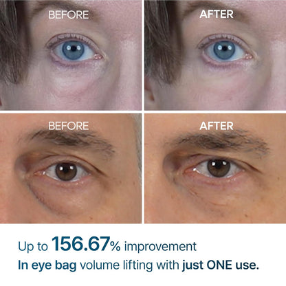 Dr.Melaxin, Eyephalt, Eyecream for Eyebags(Original)